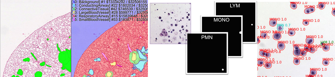 post lung neural network